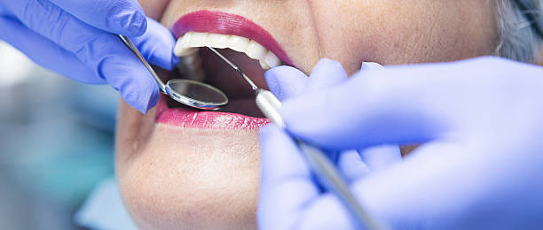 Best Emergency Gum Treatment in Riddle, OR